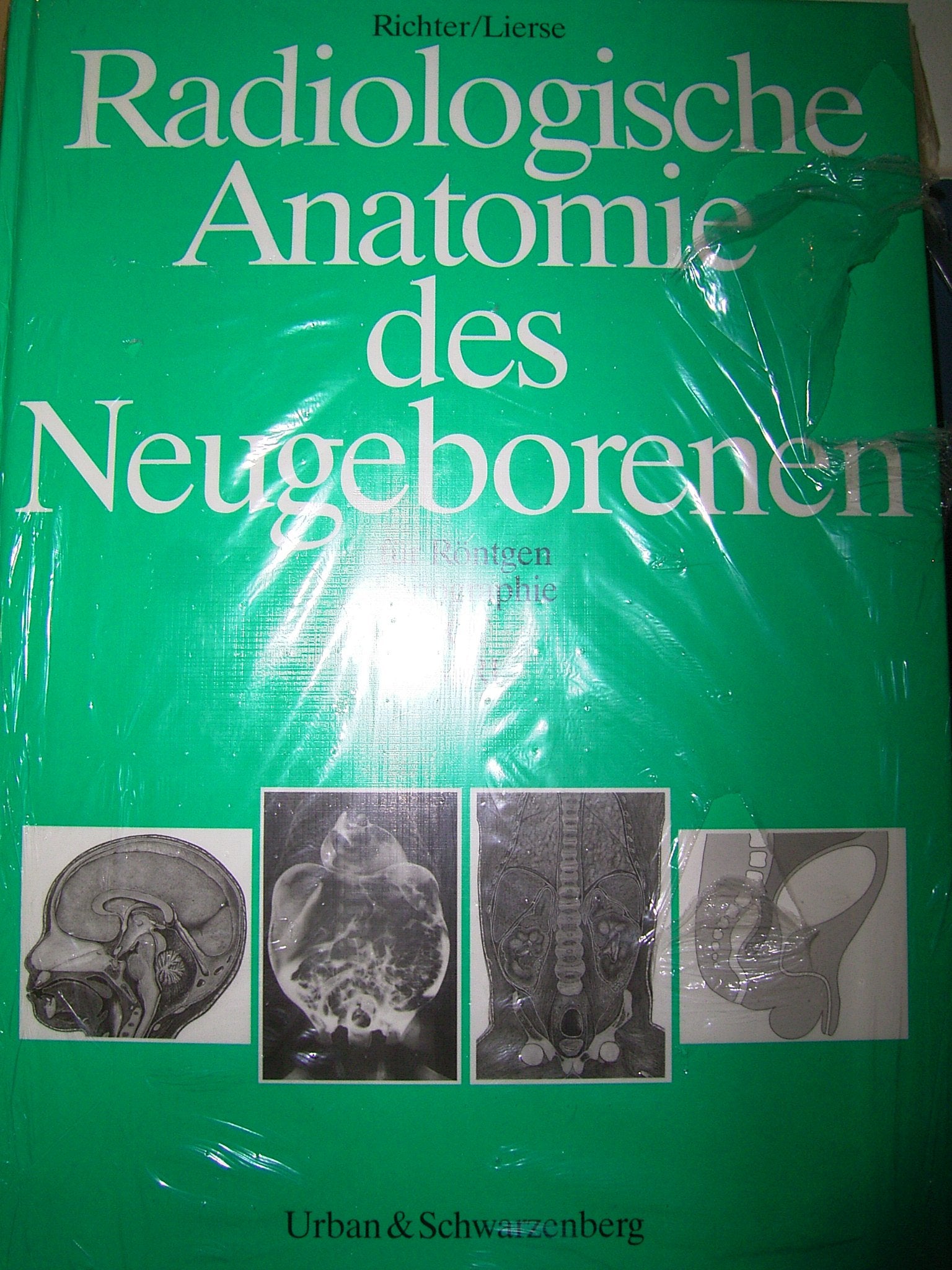 Radiologische Anatomie des Neugeborenen für Röntgen, Sonographie, CT, MRI Medicine