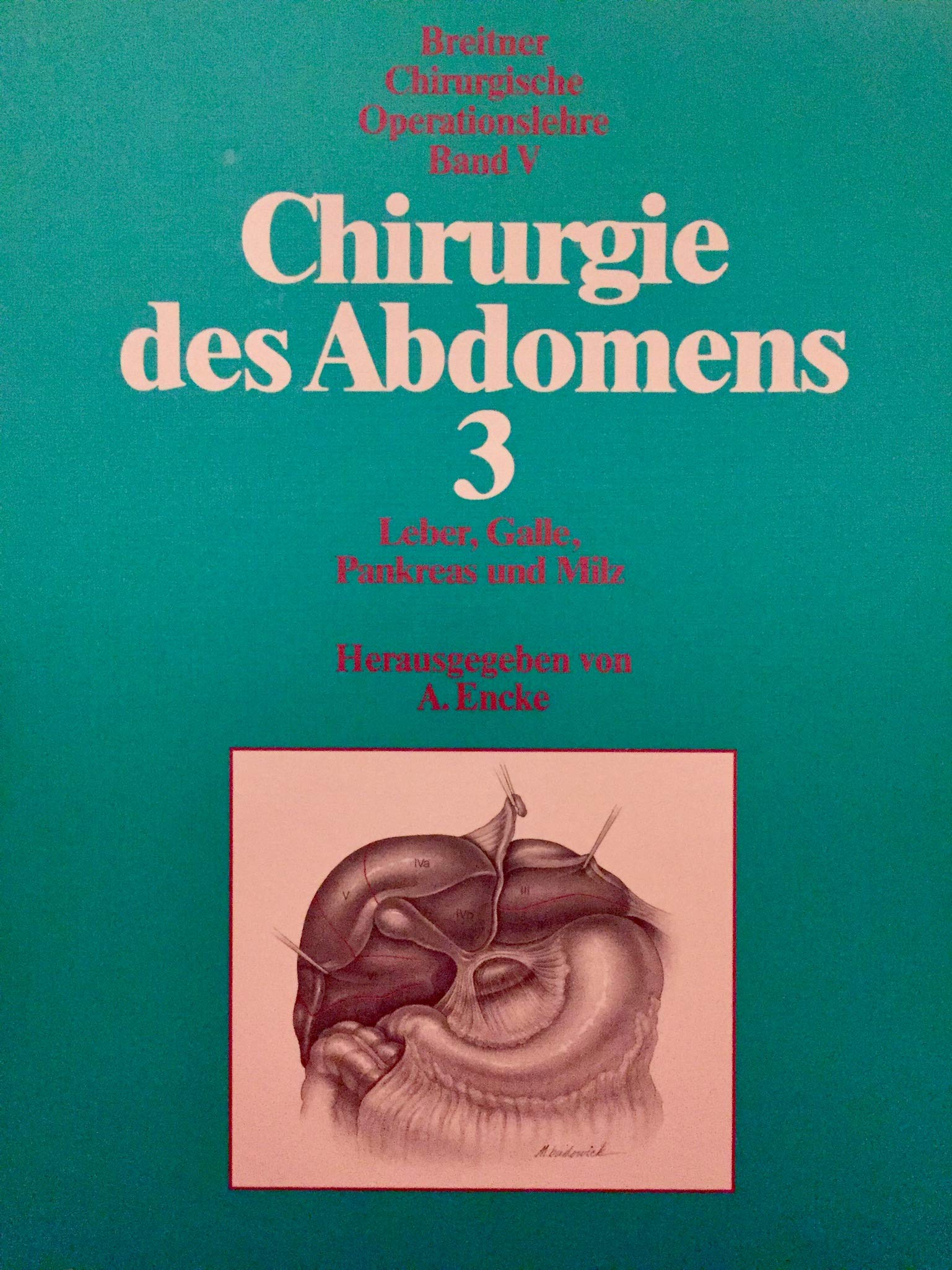 Chirurgische Operationslehre, 14 Bde., Bd.5, Chirurgie des Abdomens Medicine