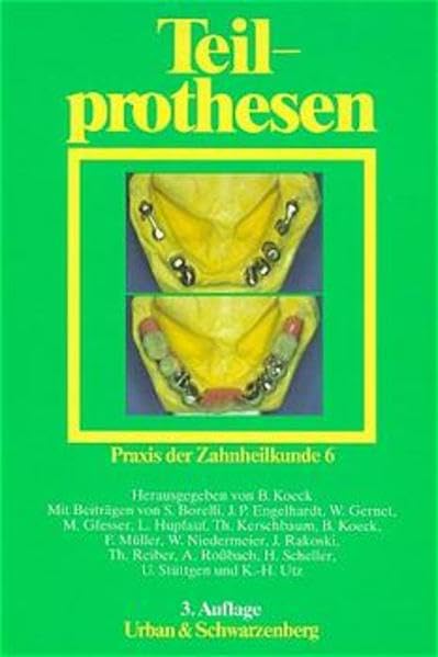 Praxis der Zahnheilkunde - PdZ. Strukturiert nach dem PermaNova-Verfahren: Praxis der Zahnheilkunde, 14 Bde. in 16 Tl.-Bdn., Bd.6, Teilprothesen Medicine