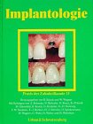 Praxis der Zahnheilkunde, 13 Bde. in 15 Tl.-Bdn., Bd.13, Implantologie Books