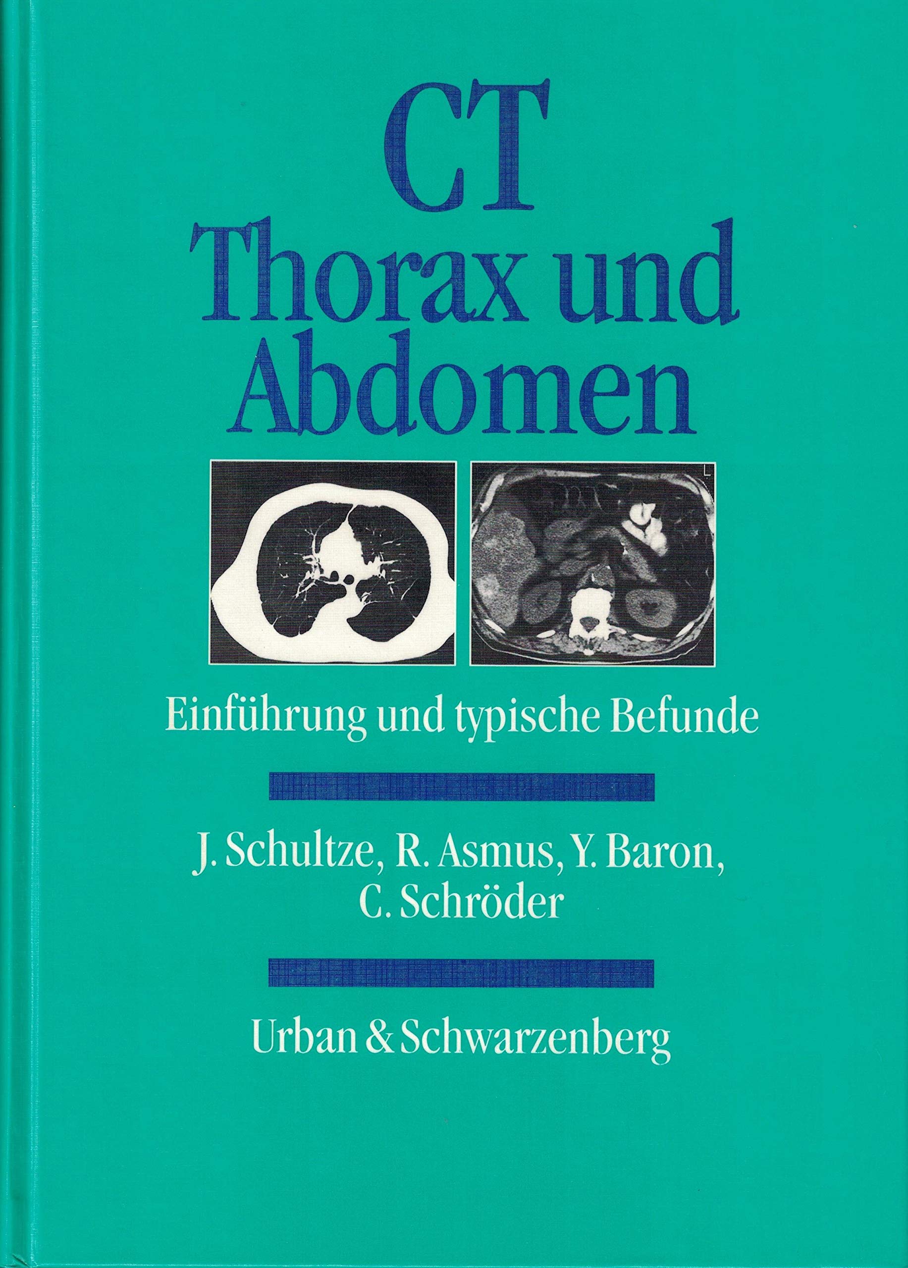 CT, Thorax und Abdomen Medicine
