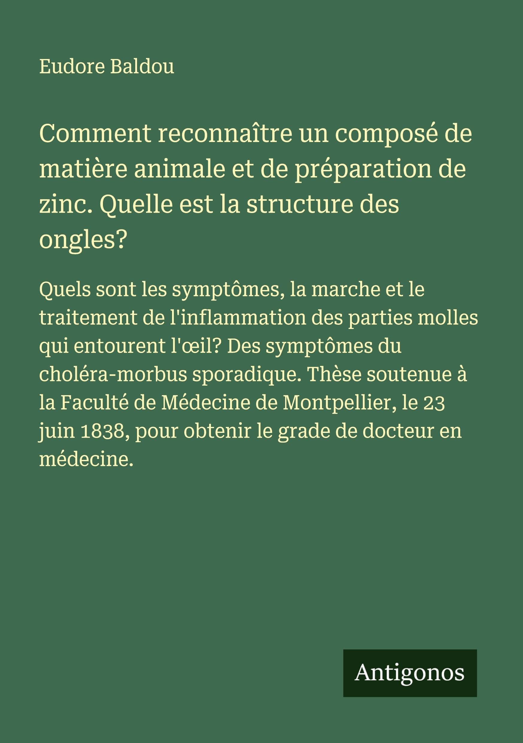 Comment reconnaître un composé de matière animale et de préparation de zinc. Quelle est la structure des ongles? Classics
