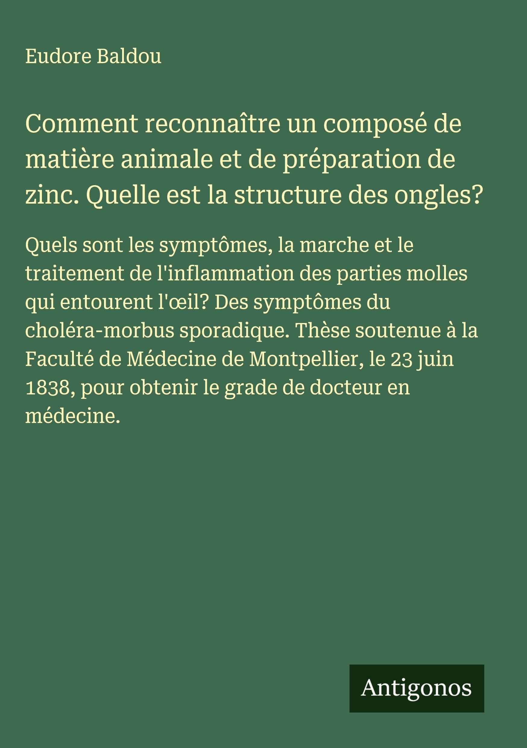 Comment reconnaître un composé de matière animale et de préparation de zinc. Quelle est la structure des ongles? Classics