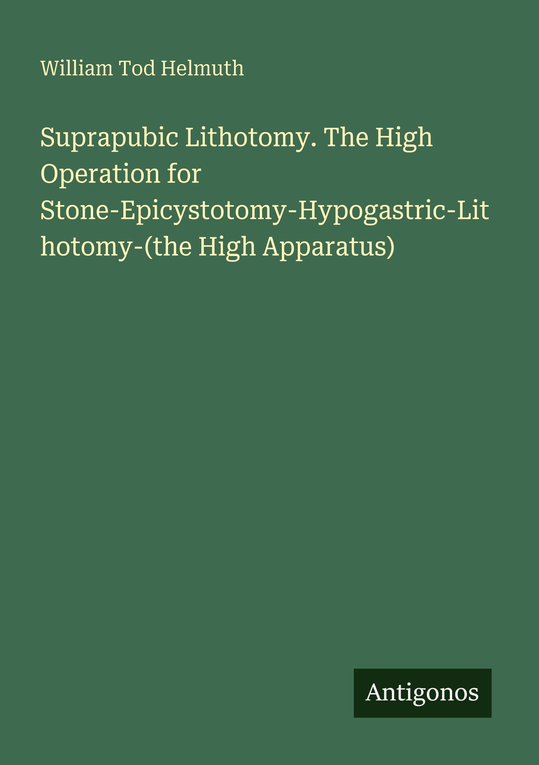 Suprapubic Lithotomy. The High Operation for Stone-Epicystotomy-Hypogastric-Lithotomy-(the High Apparatus) Classics