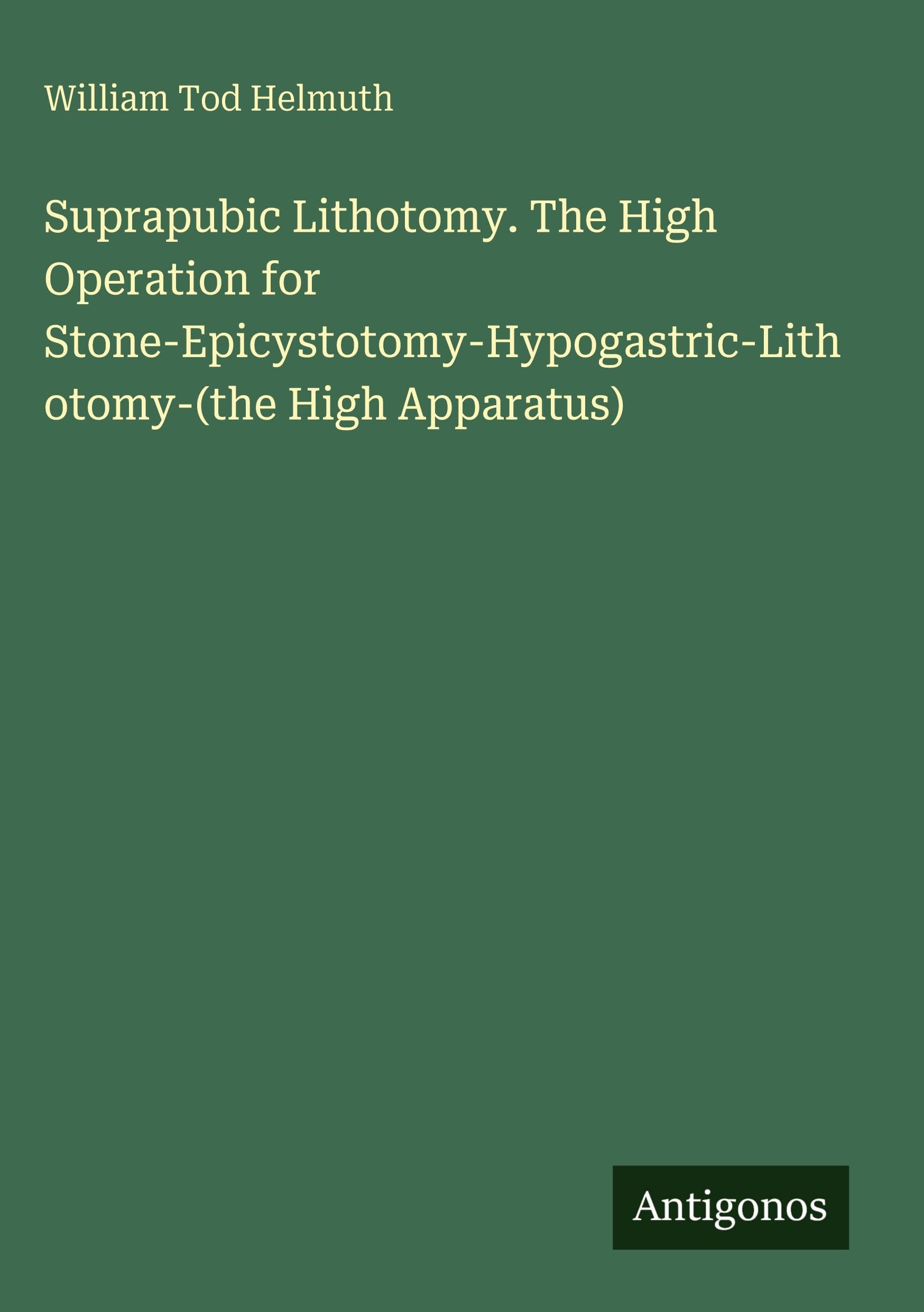 Suprapubic Lithotomy. The High Operation for Stone-Epicystotomy-Hypogastric-Lithotomy-(the High Apparatus) Classics