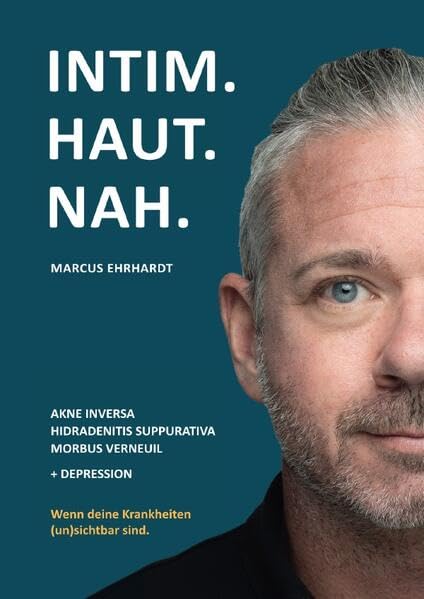 Intim.Haut.Nah.: Akne inversa, Hidradenitis suppurativa, Morbus Verneuil + Depression. Wenn deine Krankheiten (un)sichtbar sind. Medicine