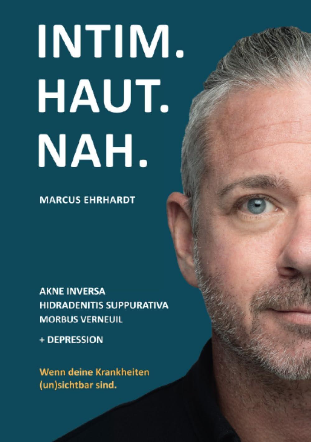 Intim.Haut.Nah.: Akne inversa, Hidradenitis suppurativa, Morbus Verneuil + Depression. Wenn deine Krankheiten (un)sichtbar sind. Medicine