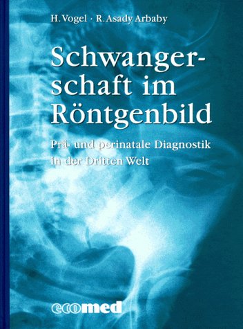 Schwangerschaft im Röntgenbild: Prä- und perinatale Diagnostik in der Dritten Welt (ecomed Medizin & Biowissenschaften) Medicine
