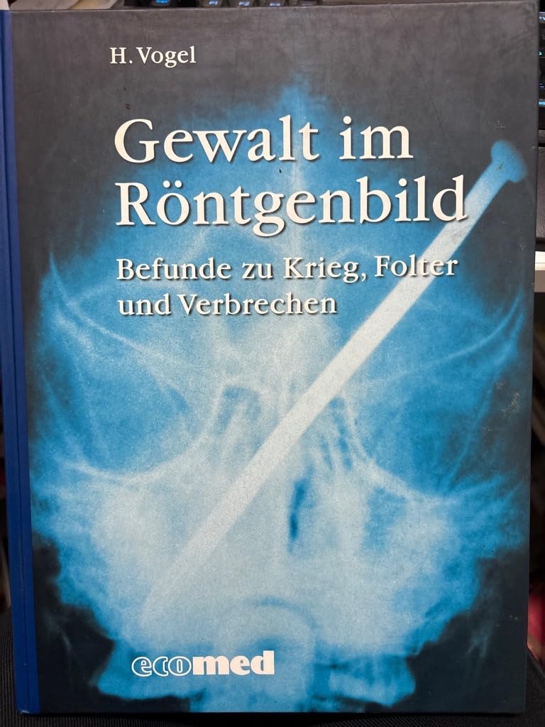 Gewalt im Röntgenbild: Befunde zu Krieg, Folter und Verbrechen (ecomed Medizin & Biowissenschaften) Medicine