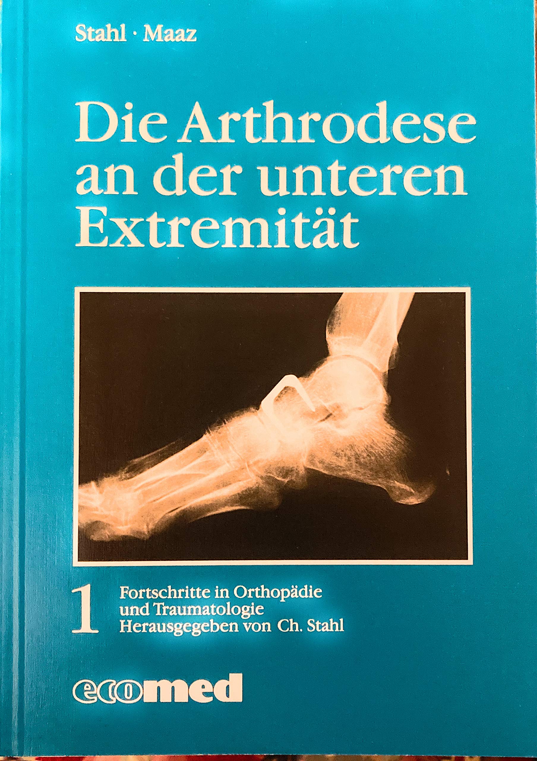 Die Arthrodese an der unteren Extremität (Fortschritte in Orthopädie und Traumatologie) Medicine