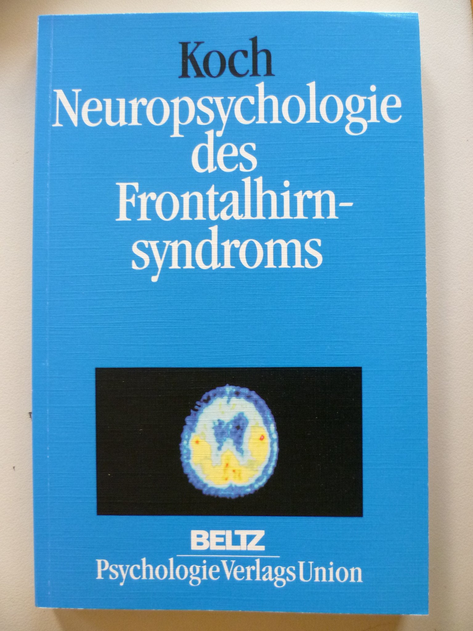 Neuropsychologie des Frontalhirnsyndroms Books