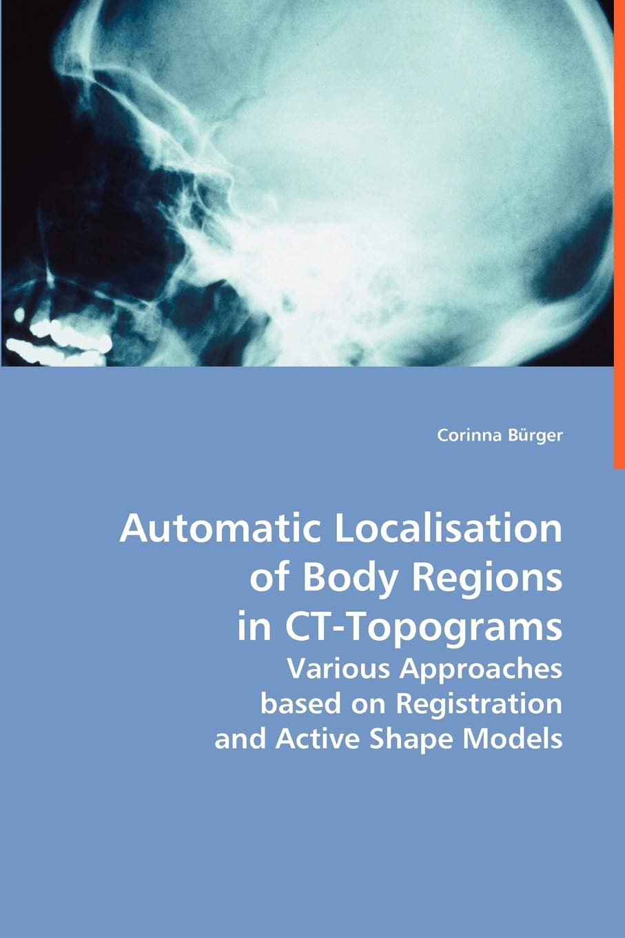 Automatic Localisation of Body Regions in Ct Topograms book