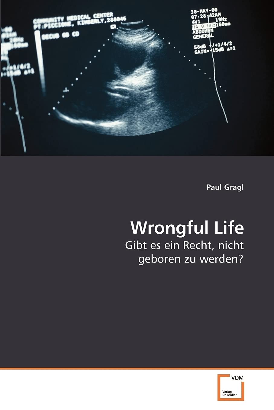 Wrongful Life: Gibt es ein Recht, nicht geboren zu werden? book
