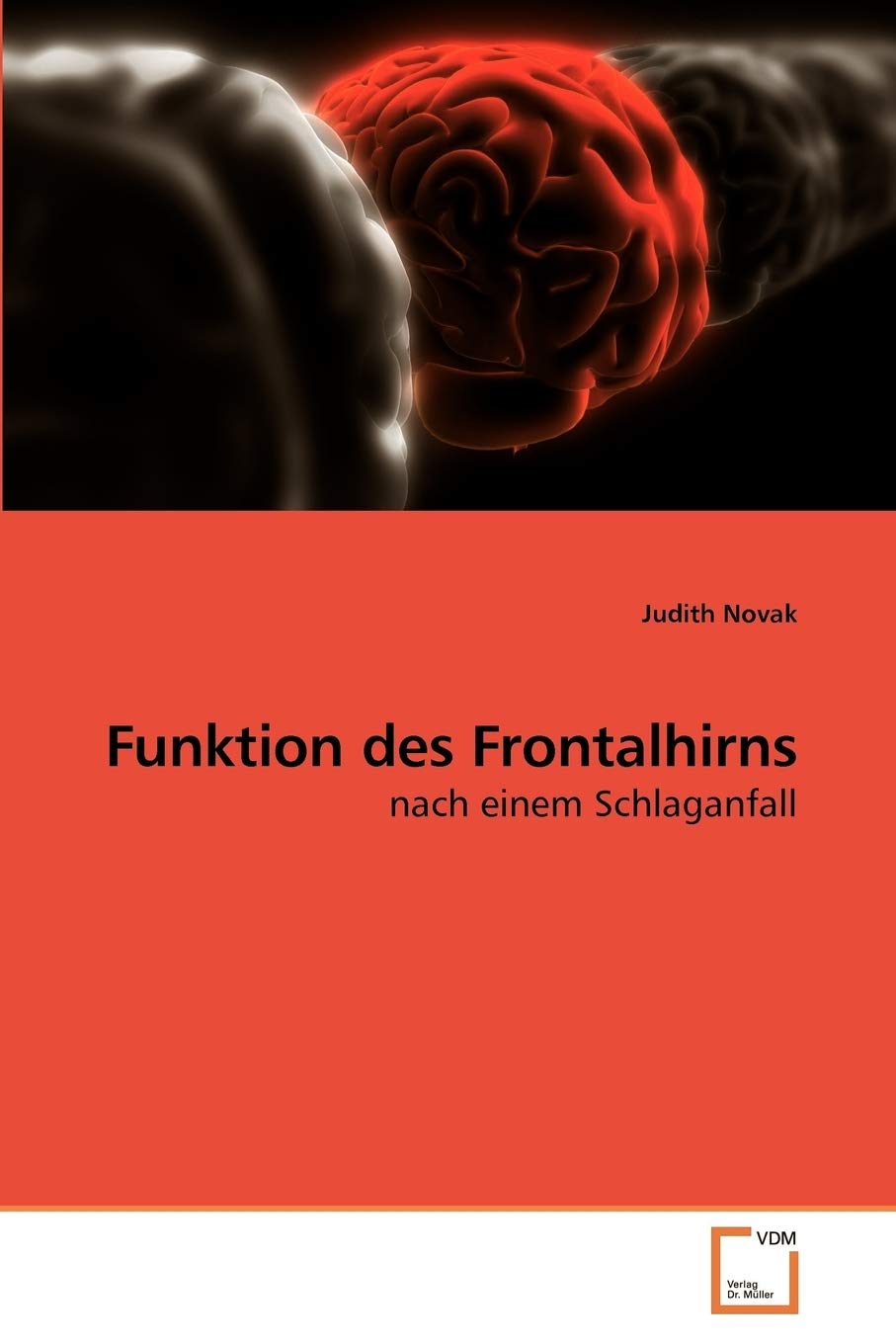 Funktion des Frontalhirns: nach einem Schlaganfall Medicine