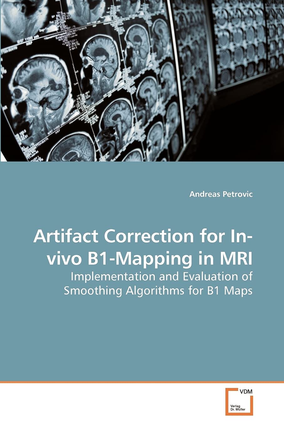 Artifact Correction for In-vivo B1-Mapping in MRI: Implementation and Evaluation of Smoothing Algorithms for B1 Maps Business & Technology