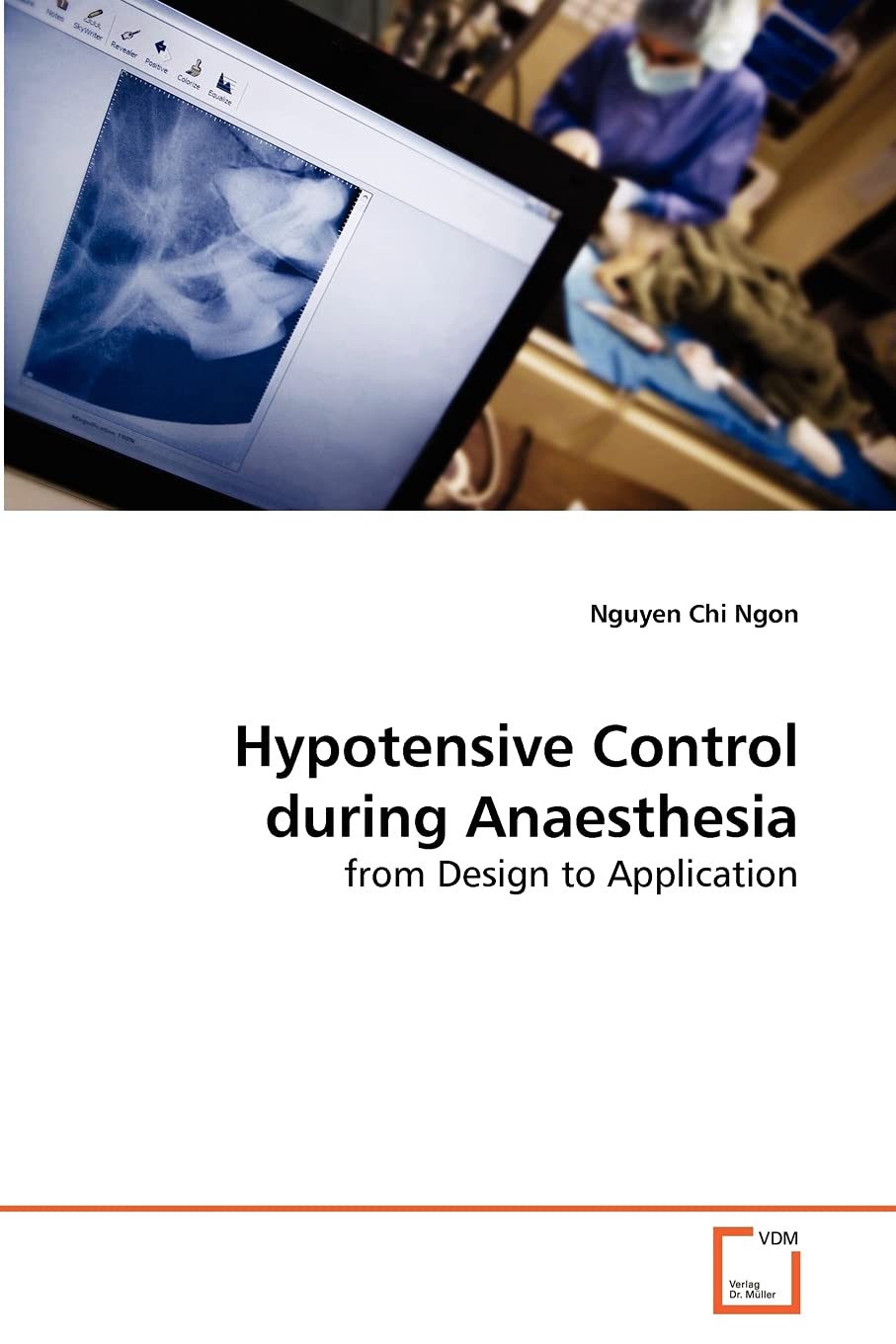 Hypotensive Control during Anaesthesia: from Design to Application Business & Technology