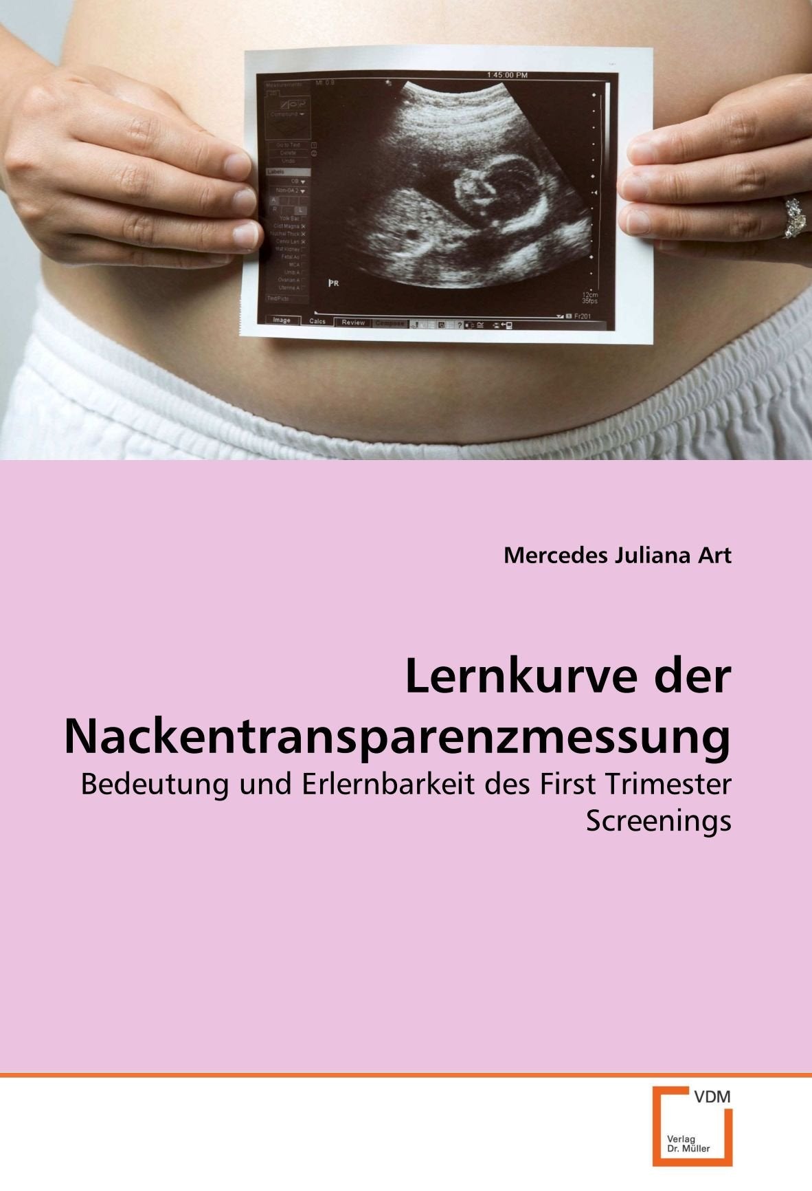 Lernkurve der Nackentransparenzmessung book