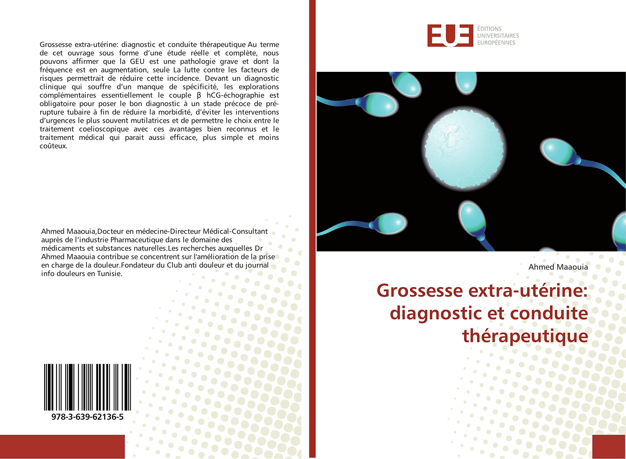 Grossesse extra-utérine: diagnostic et conduite thérapeutique Medicine