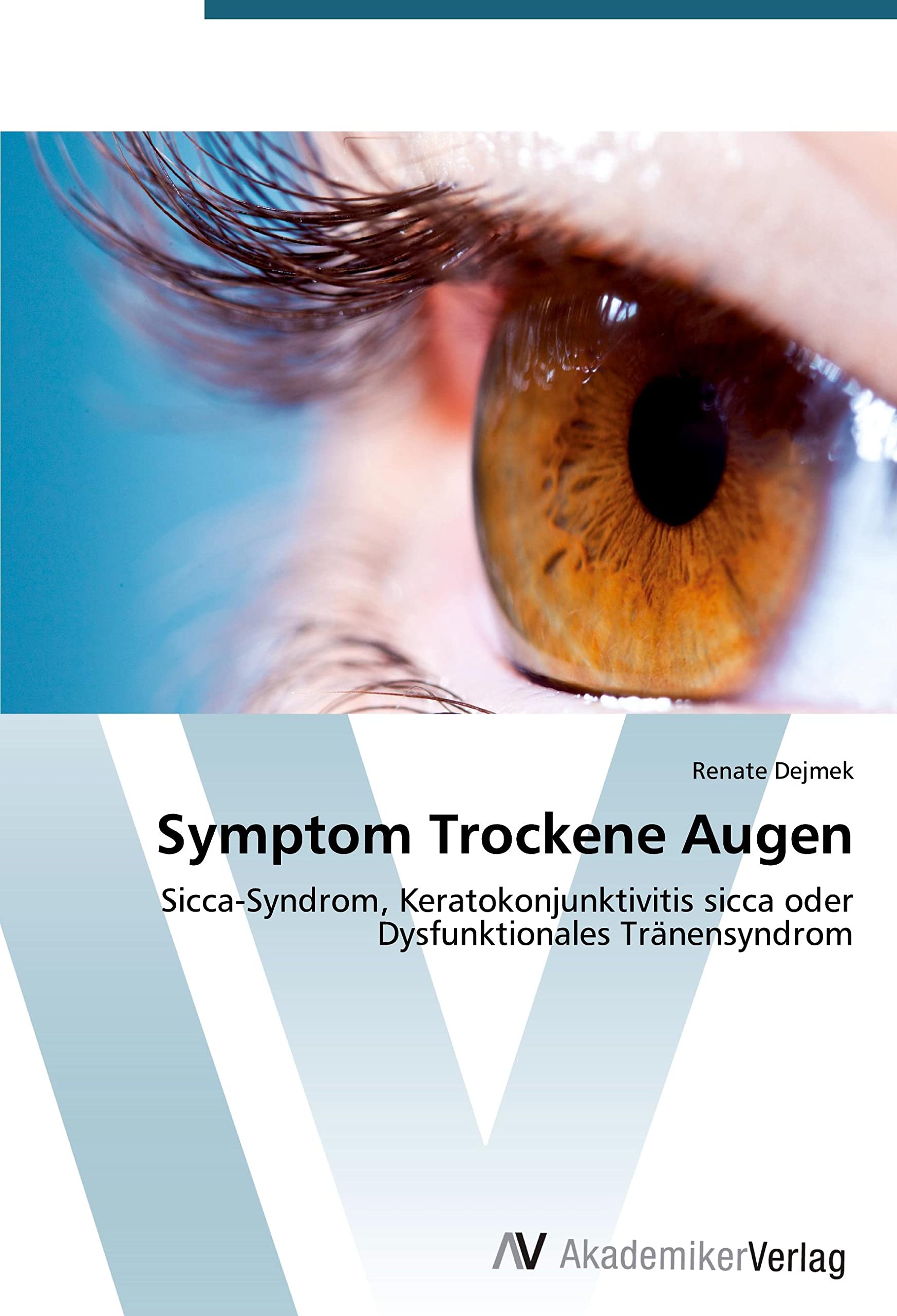 Symptom Trockene Augen: Sicca-Syndrom, Keratokonjunktivitis sicca oder Dysfunktionales Tränensyndrom Medicine