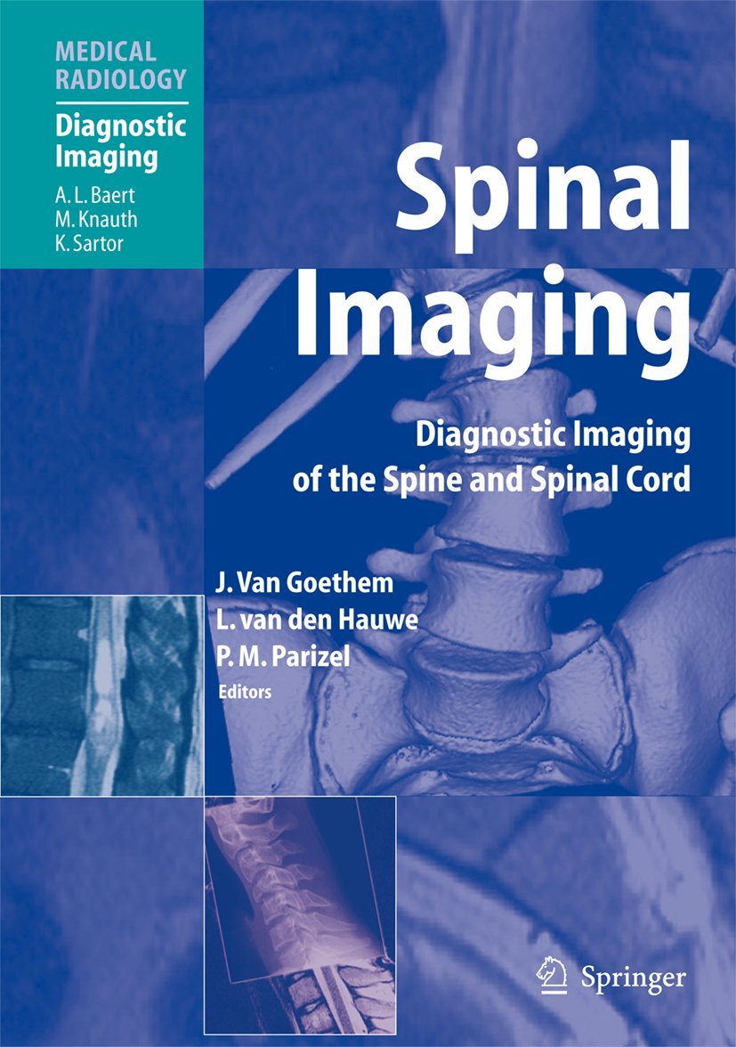 Spinal Imaging: Diagnostic Imaging of the Spine and Spinal Cord Medicine