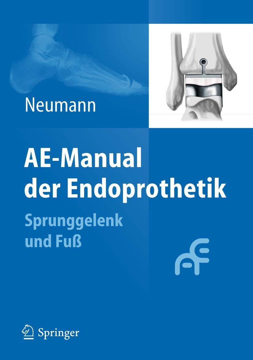 AE-Manual der Endoprothetik: Sprunggelenk und Fuß Medicine