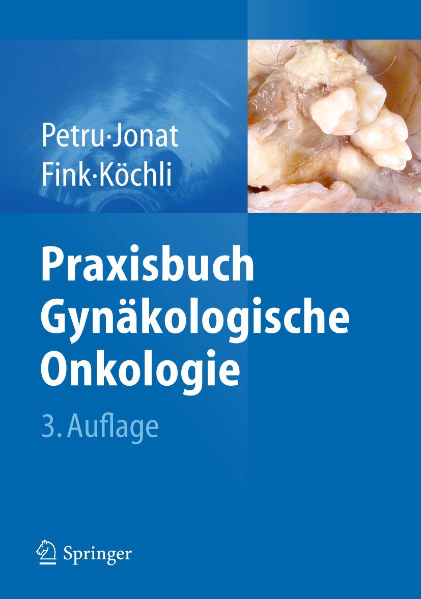 Praxisbuch Gynäkologische Onkologie Medicine