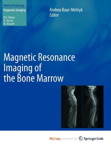 Magnetic Resonance Imaging of the Bone Marrow Medicine