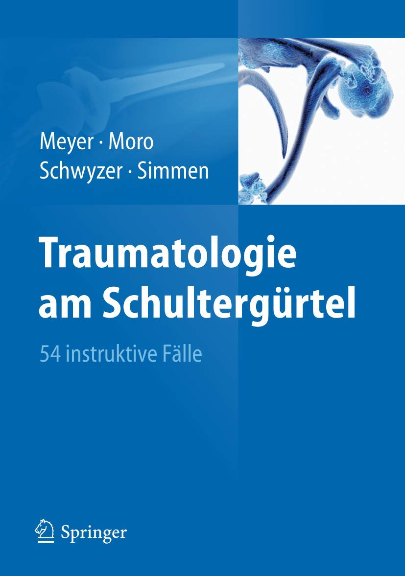 Traumatologie am Schultergürtel book