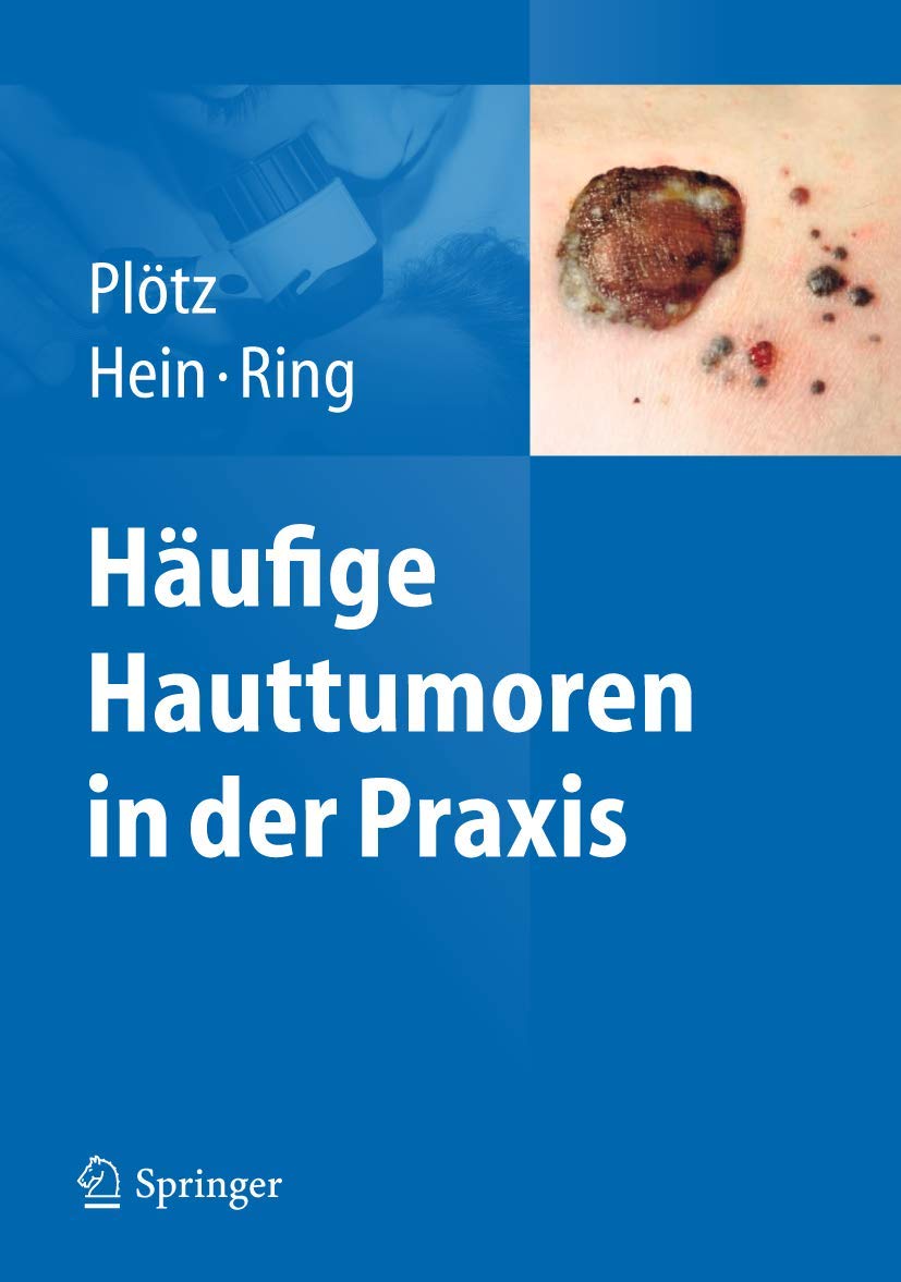 Product Image: Häufige Hauttumoren in der Praxis