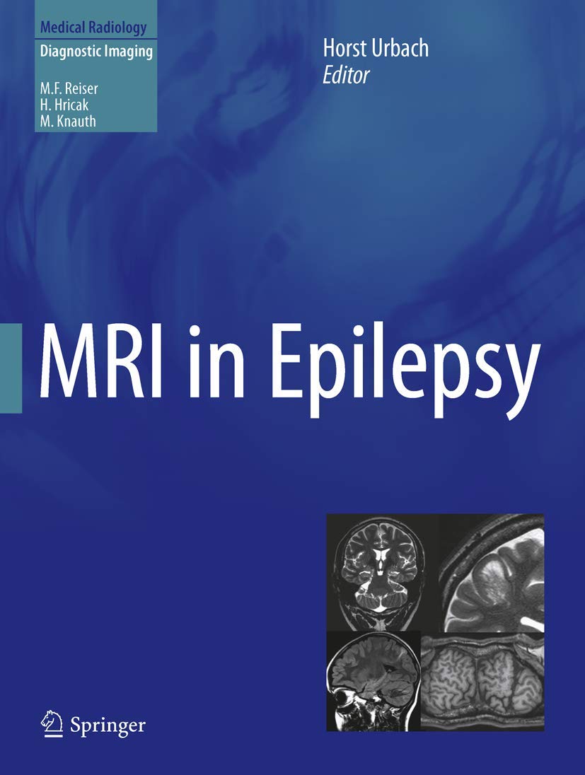 MRI in Epilepsy (Medical Radiology) Medicine