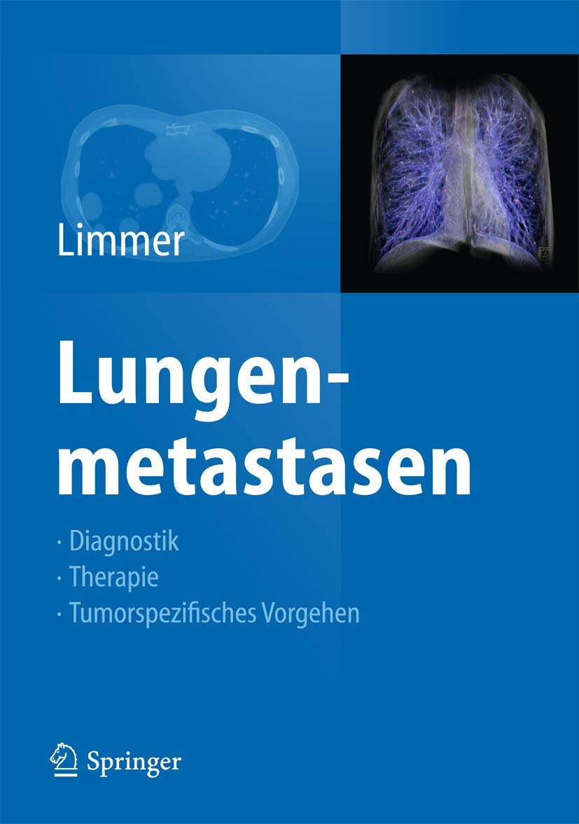 Lungenmetastasen: Diagnostik - Therapie - Tumorspezifisches Vorgehen Medicine