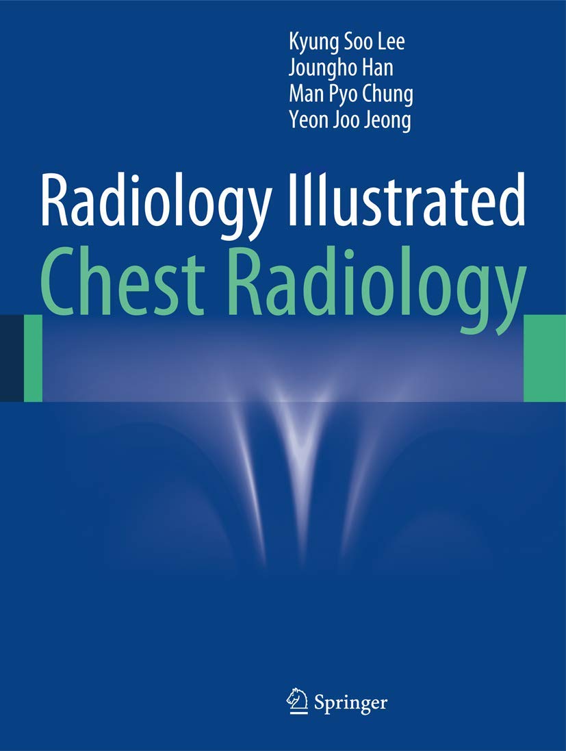 Radiology Illustrated: Chest Radiology book