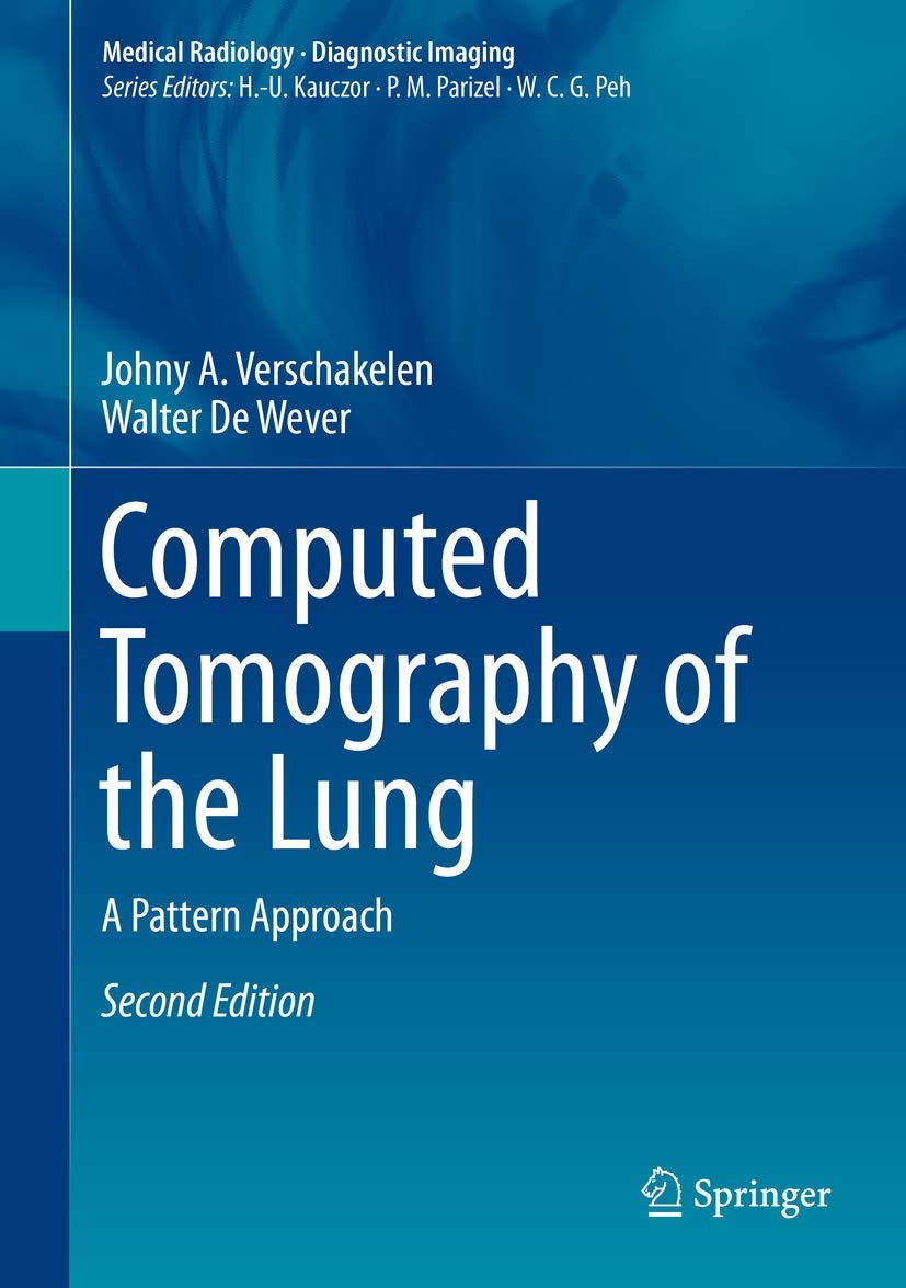 Computed Tomography of the Lung: A Pattern Approach (Medical Radiology) Medicine