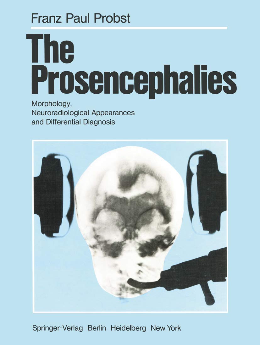 The Prosencephalies: Morphology, Neuroradiological Appearances and Differential Diagnosis Medicine