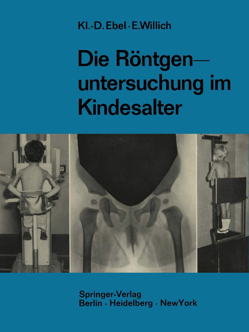 Die Röntgenuntersuchung im Kindesalter: Technik und Indikation Medicine