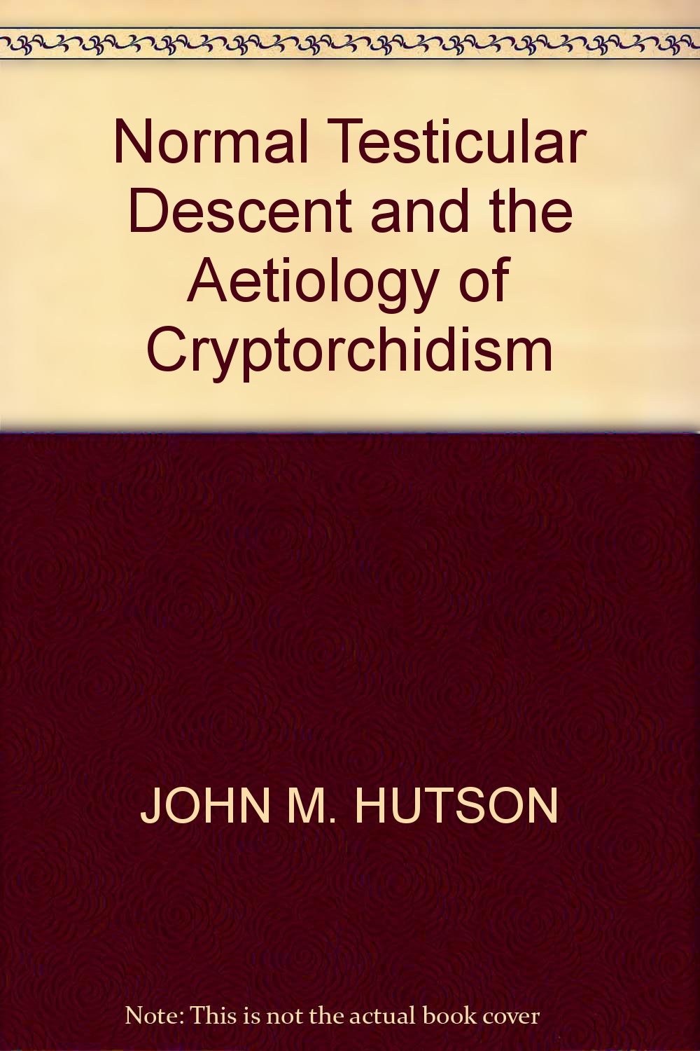 Normal Testicular Descent and the Aetiology of Cryptorchidism Medicine
