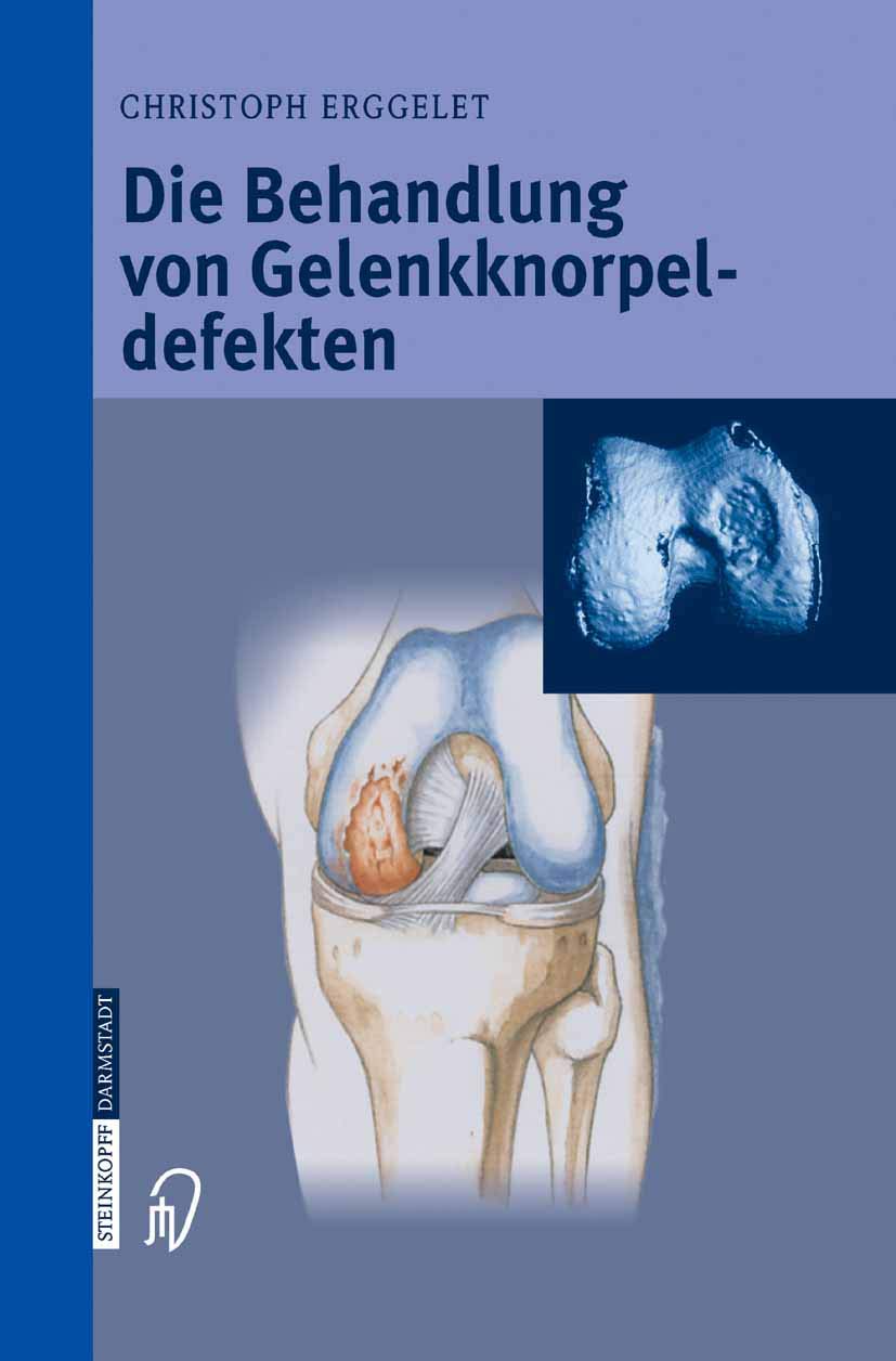 Die Behandlung von Gelenkknorpeldefekten Medicine