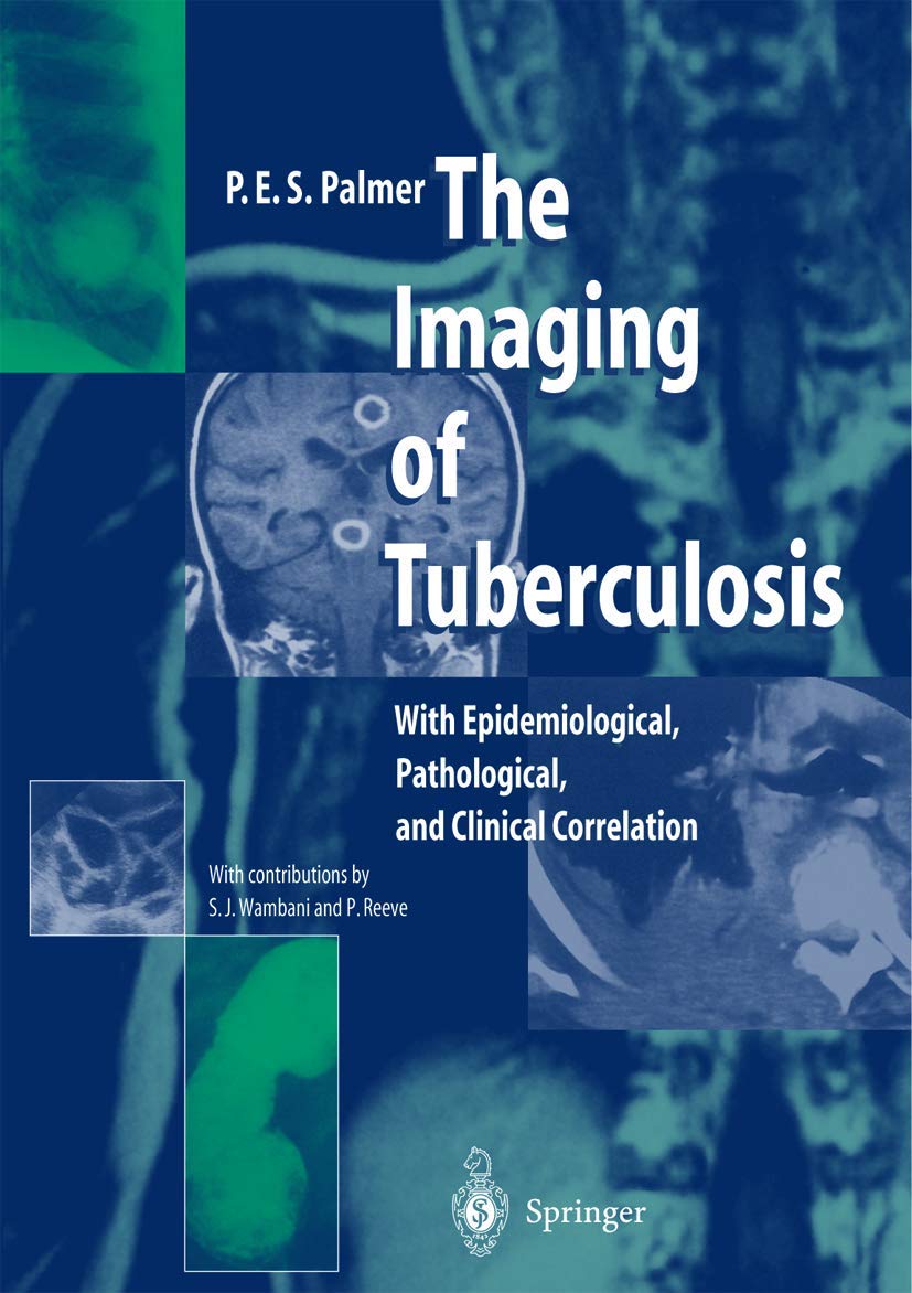 The Imaging of Tuberculosis: With Epidemiological, Pathological, and Clinical Correlation Medicine