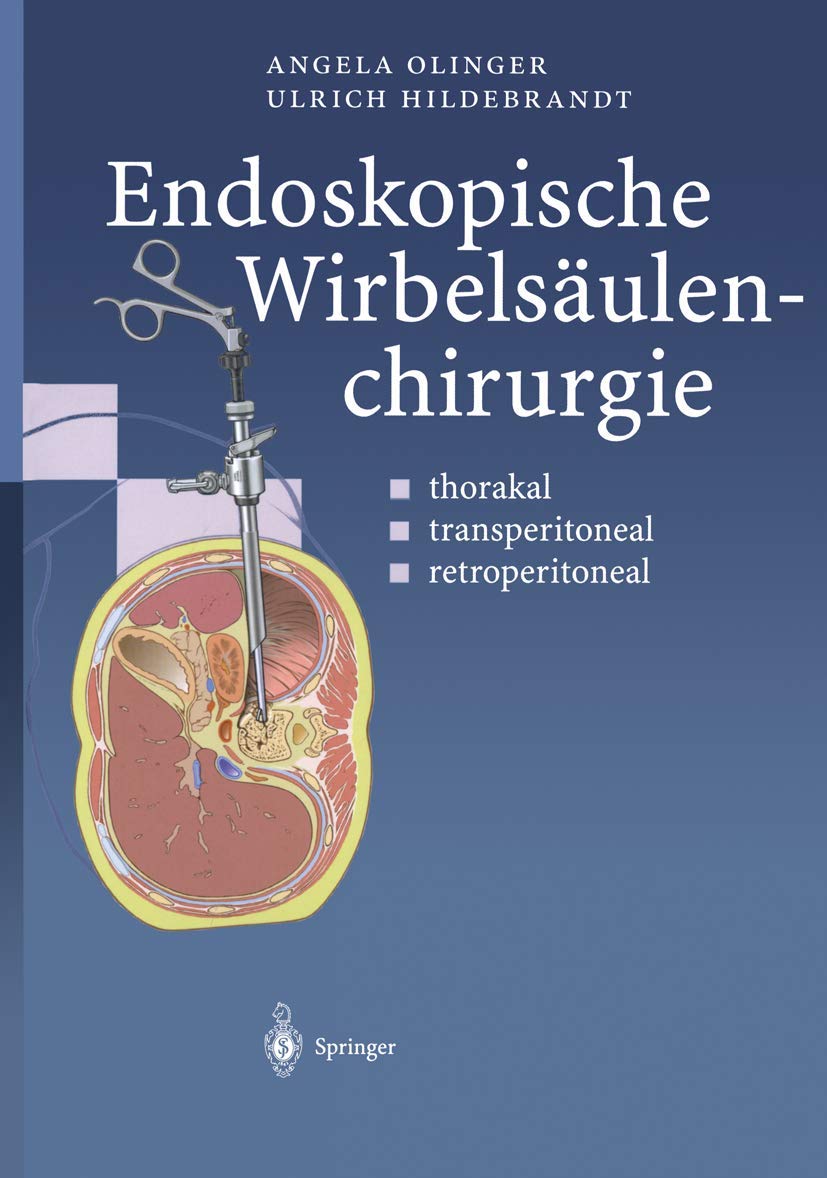 Endoskopische Wirbelsäulenchirurgie: thorakal · transperitoneal · retroperitoneal Medicine