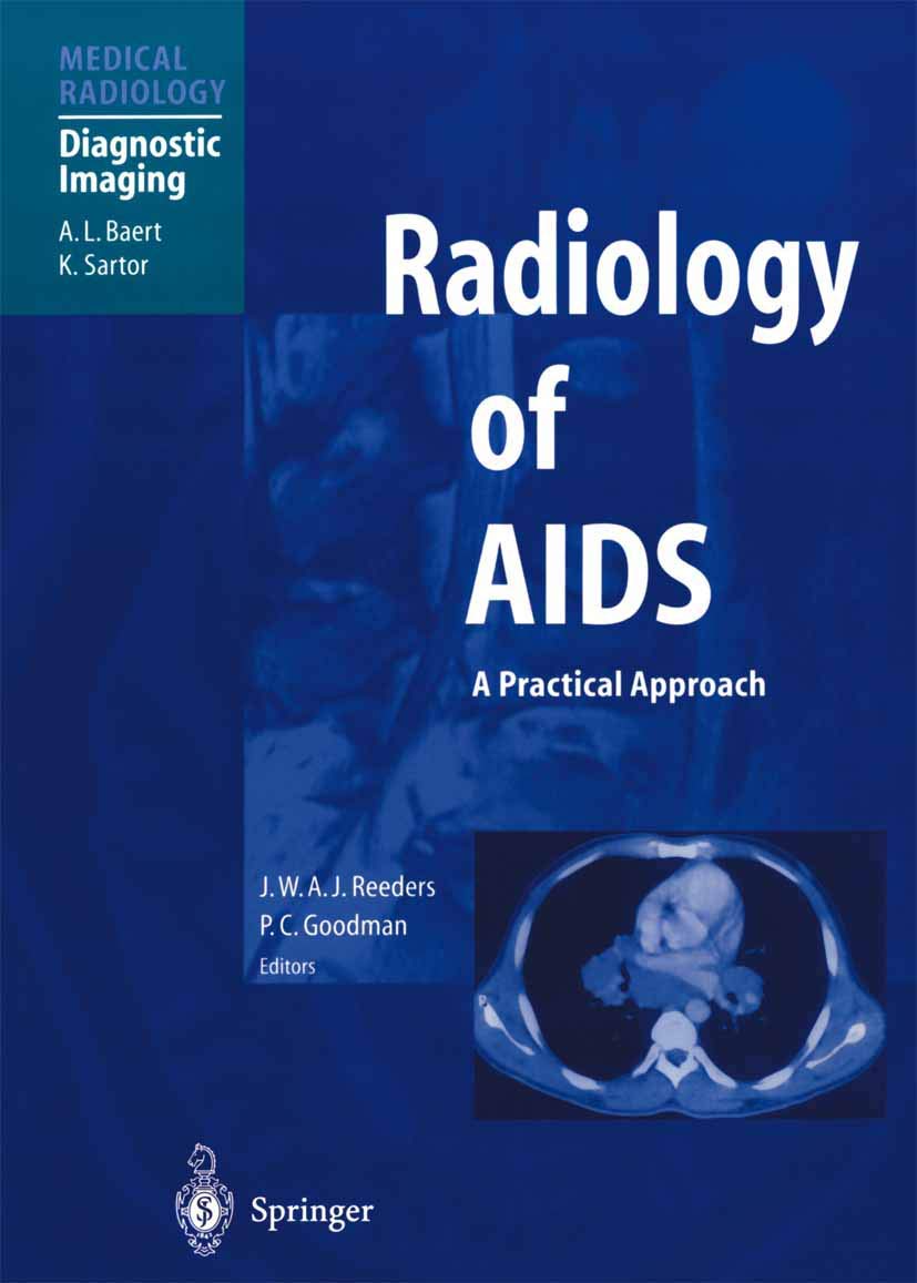 Radiology of AIDS (Diagnostic Imaging) Medicine