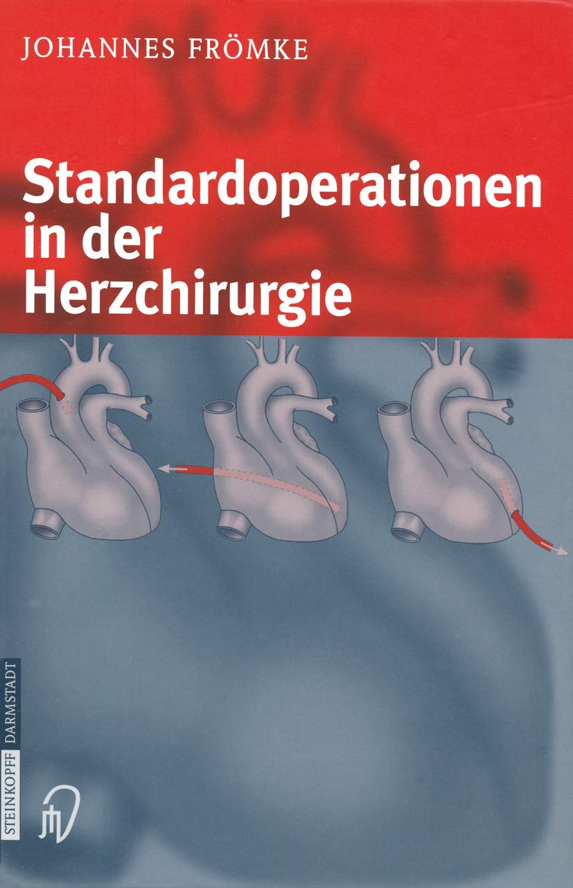 Standardoperationen in der Herzchirurgie Medicine
