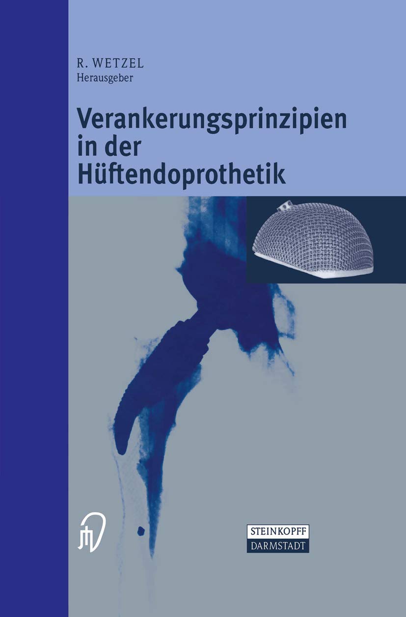 Verankerungsprinzipien in der Hüftendoprothetik book