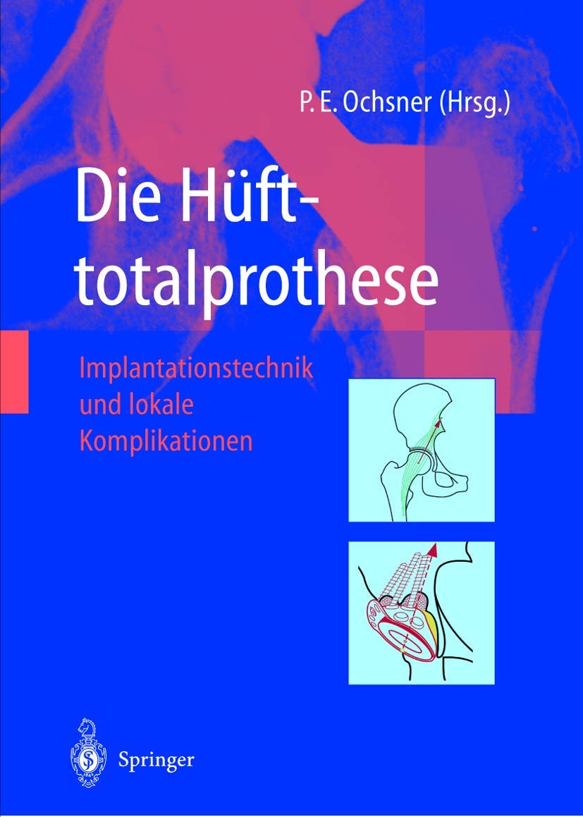 Die Hüfttotalprothese: Implantationstechnik und lokale Komplikationen Medicine