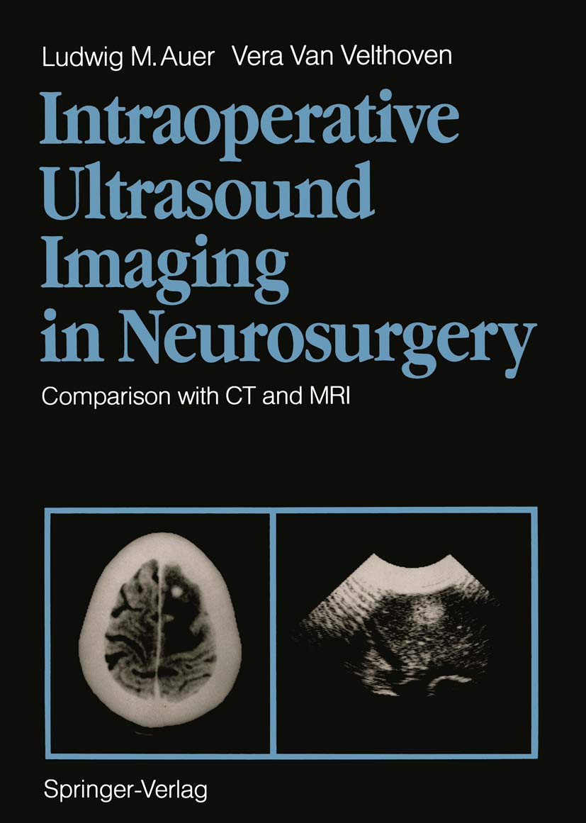 Intraoperative Ultrasound Imaging in Neurosurgery: Comparison with CT and MRI Medicine