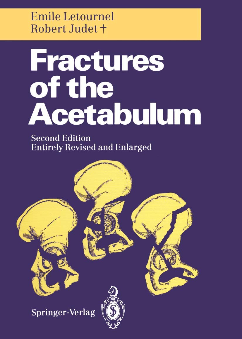 Fractures of the Acetabulum Medicine