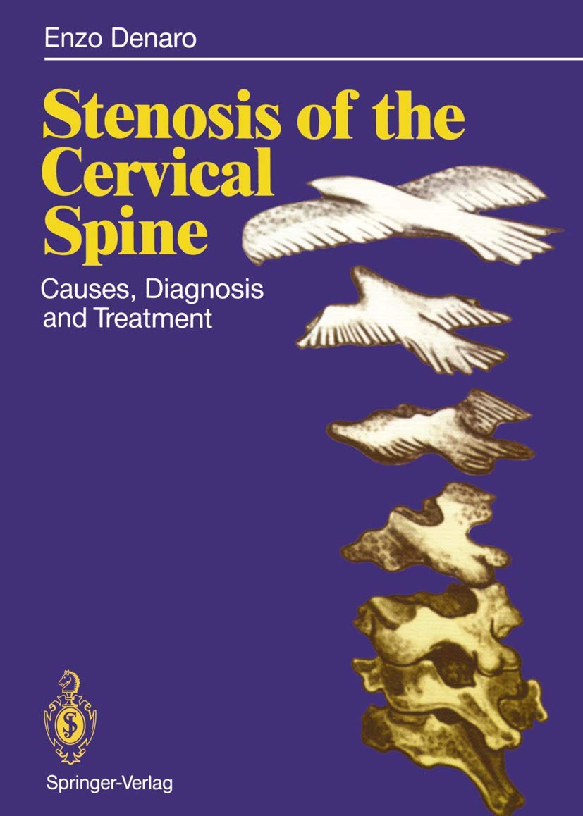 Stenosis of the Cervical Spine: Causes, Diagnosis and Treatment Medicine