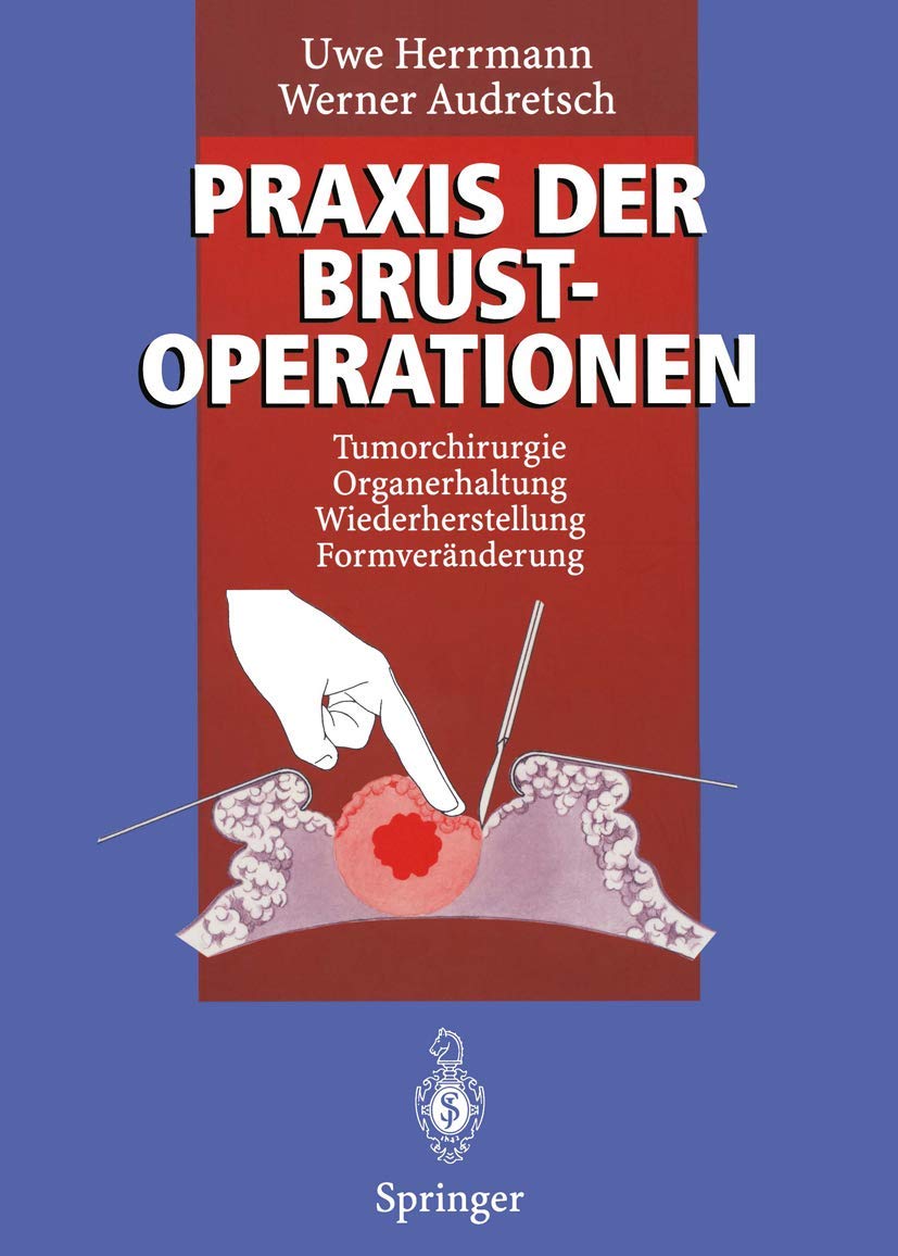 Praxis der Brustoperationen: Tumorchirurgie — Organerhaltung — Wiederherstellung — Formveränderung Medicine