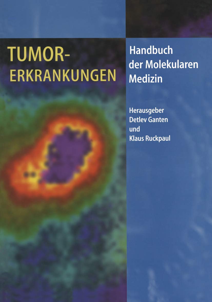 Tumorerkrankungen (Handbuch der Molekularen Medizin, 2, Band 2) Medicine