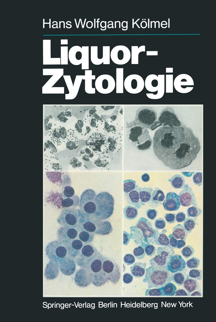 Liquor-Zytologie Medicine