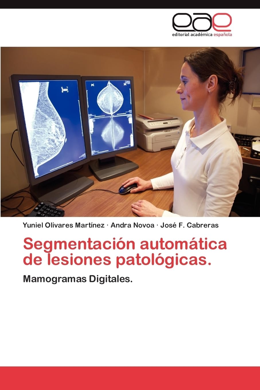 Segmentación automática de lesiones patológicas.: Mamogramas Digitales. Computer Science